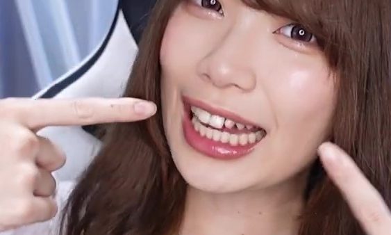 【体験記】【干物系オタク女子】Youtuberの美咲みささんが、Youtubeでビセットラインの体験動画（２）を公開しました。